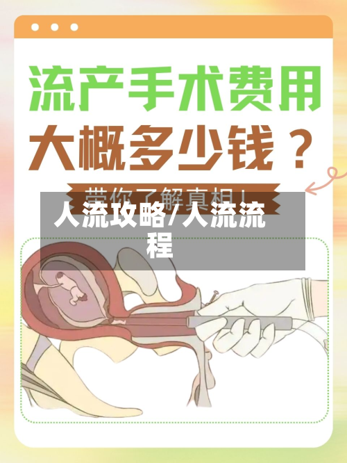人流攻略/人流流程